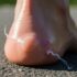 Socken und Nähte vermeiden